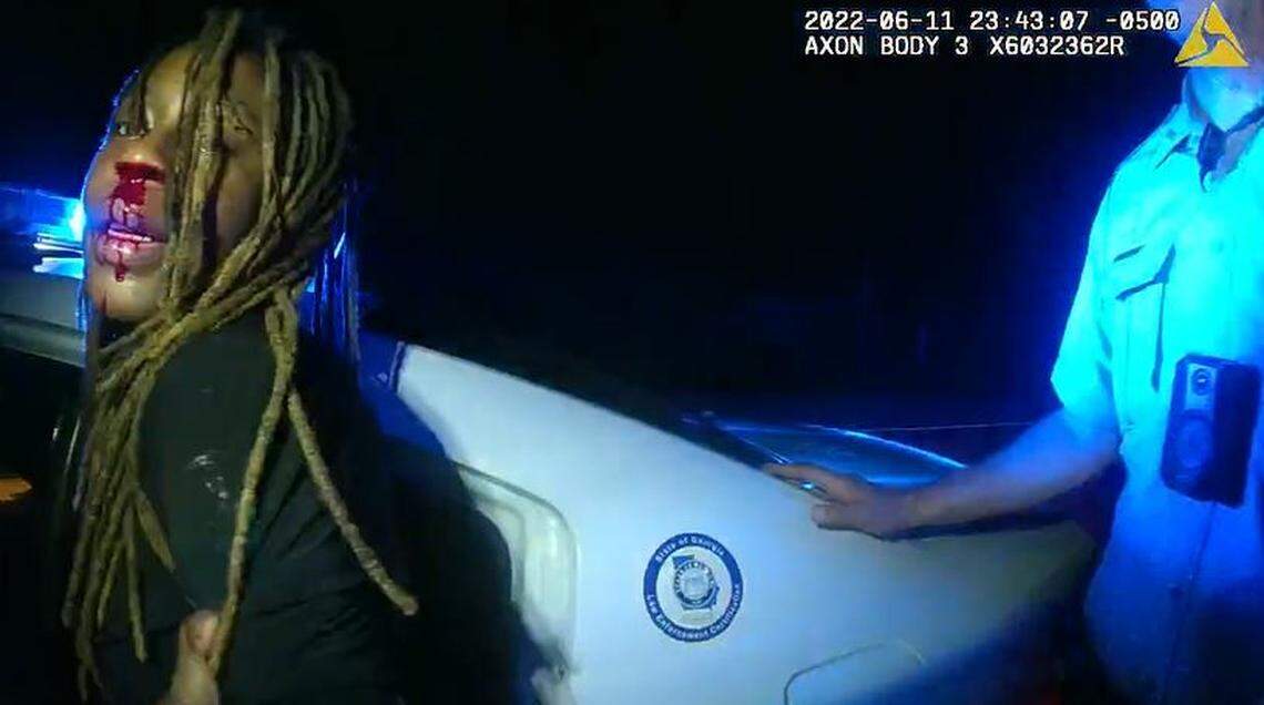 Body camera footage shows Jozzi Rainey was left bleeding in an altercation with a Bibb County Sheriff’s deputy in 2022. She’s suing over the incident.