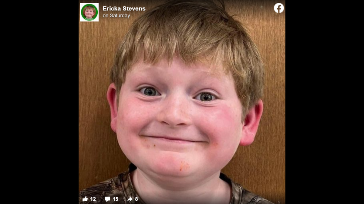Justin Gilstrap, 11, remains hospitalized after he was attacked by three dogs, his mom said.