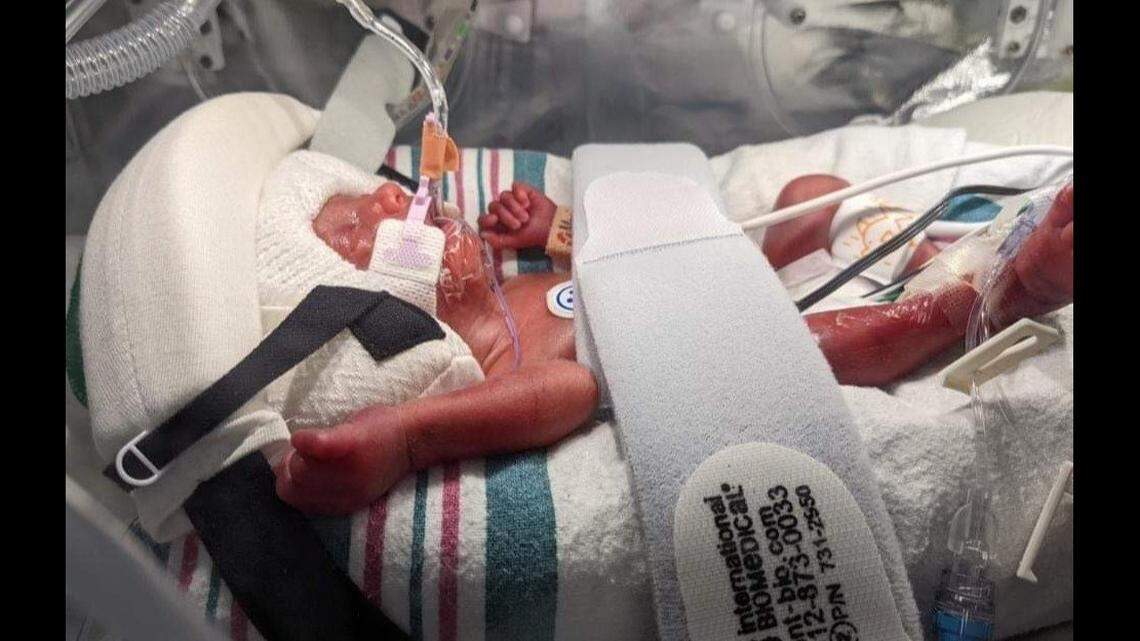 Abby Wiseman delivered her 24-week-old baby on the side of a highway in Georgia with the help of her best friend, officials say.