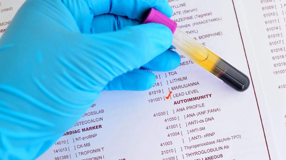 Blood sample for lead level testing