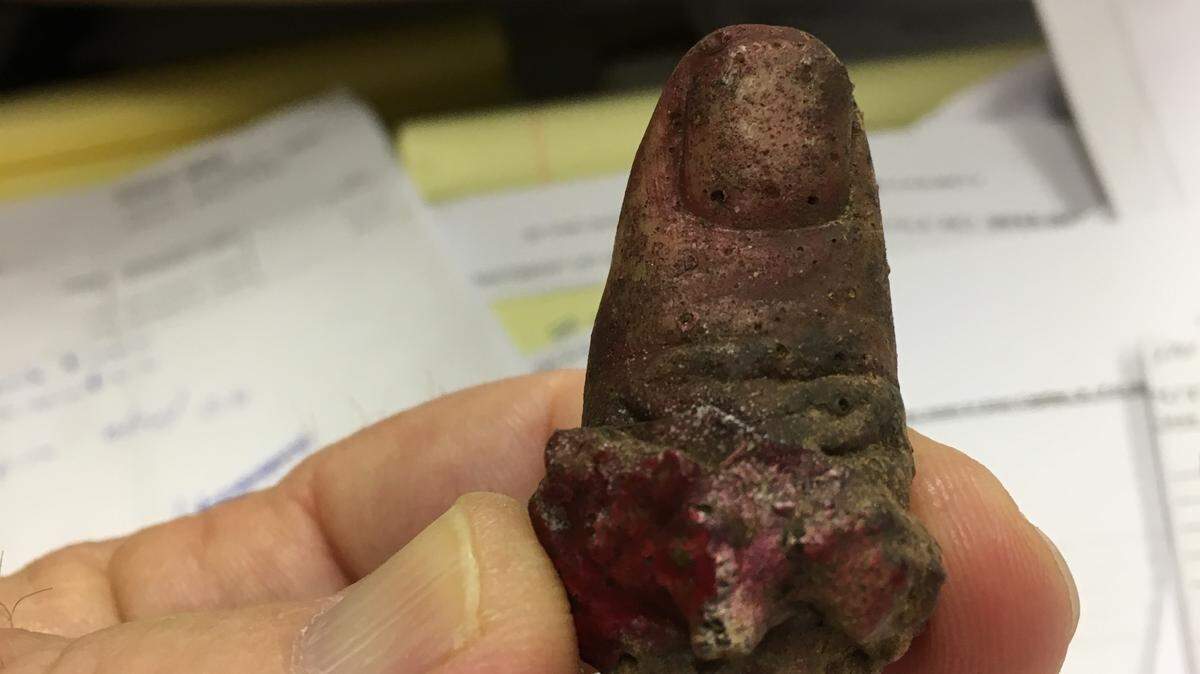 A mysterious thumb turned up Monday in a yard near Lake Oconee in Putnam County. In this picture, Putnam County Sheriff Howard Sills holds the digit in question.