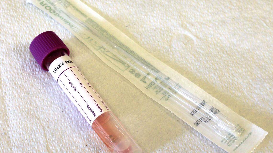 Georgia doesn’t know race of 62% of people who tested positive for COVID-19. Why?