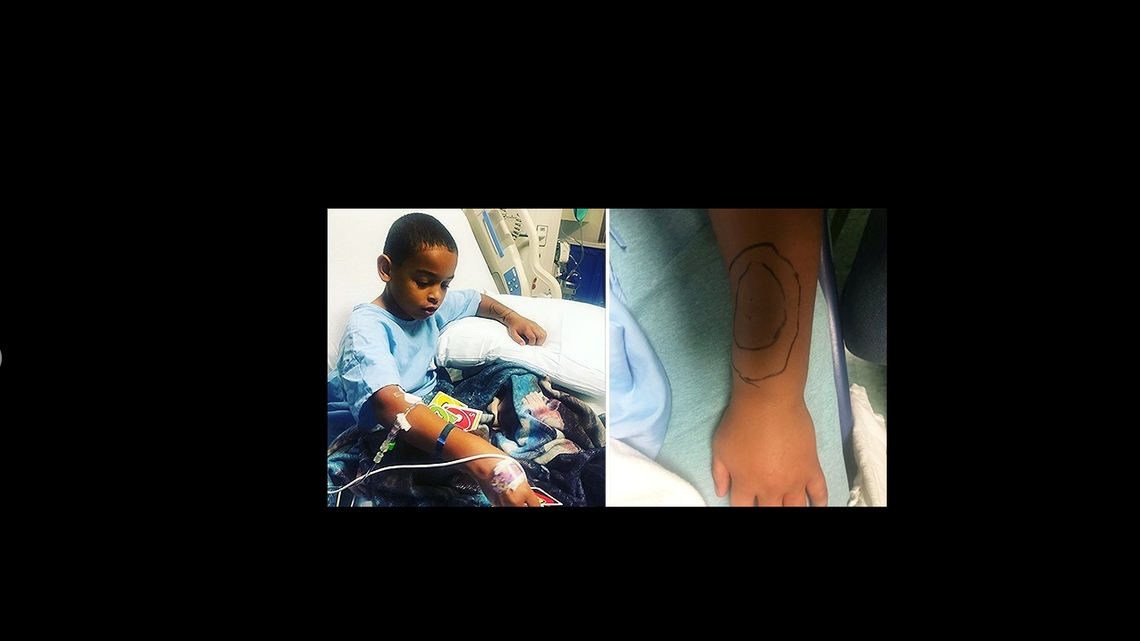 A venomous copperhead snake bite a boy after he tripped in a driveway, a Georgia hospital said. CHILDREN’S HEALTHCARE OF ATLANTA FACEBOOK SCREENGRAB