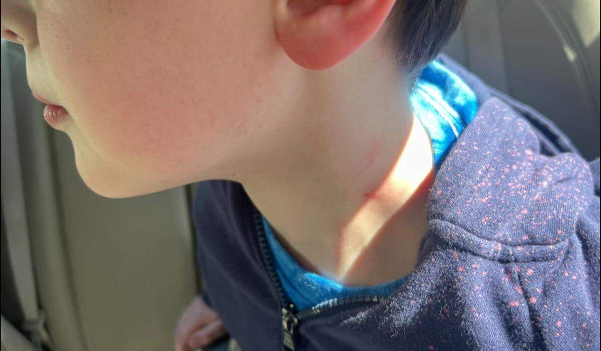 The family of a former Bibb County School District student claimed their autistic child was injured by a school bus aide and denied proper special education services, sparking a due process hearing before the Georgia Office of Administrative Hearings.