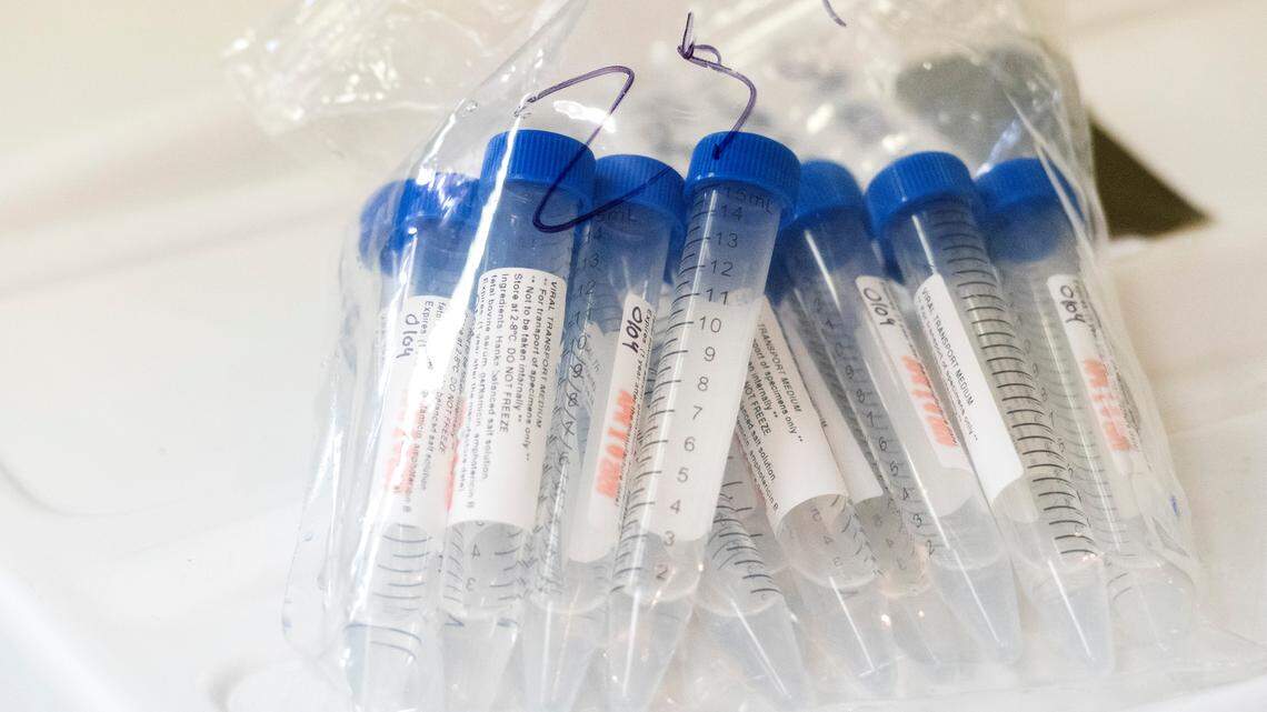 JASON VORHEES/THE TELEGRAPH Macon, GA, 04282020 Collection tubes for deep nasal swab COVID-19 test.