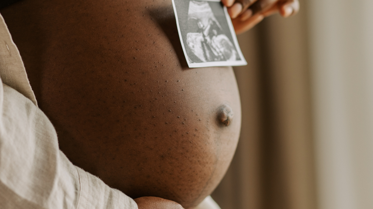 Maternal mortality rates in Georgia have increased. Here’s what to know.