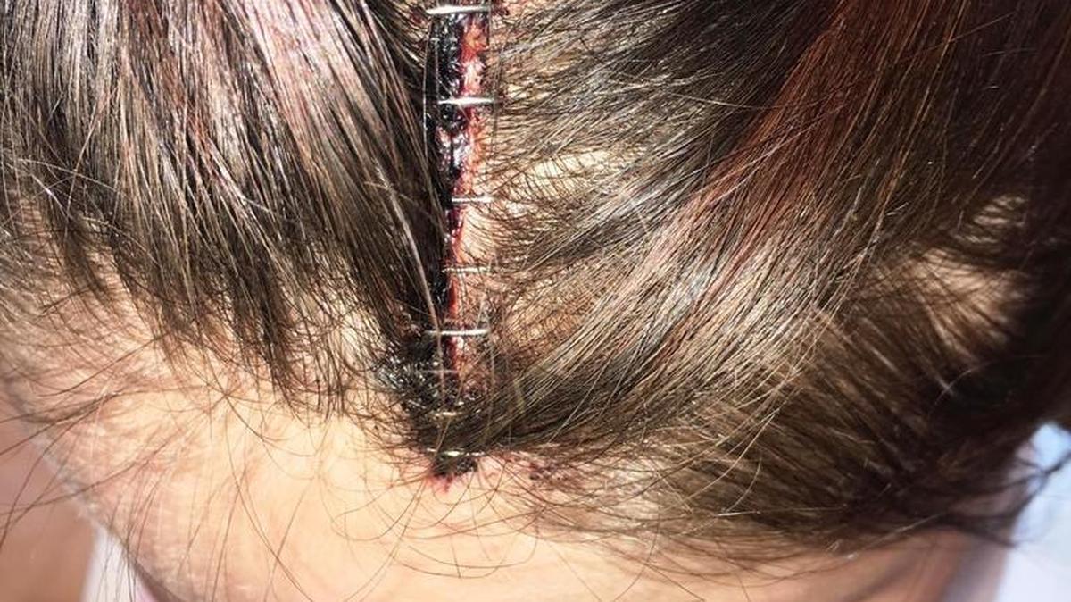 India Martin, 22, of Fort Valley, says Fort Valley police Lt. Antoine Jordan pushed her and caused her to fall and hit her head at the Medical Center of Peach County, Navicent Health. The GBI is investigating, and Jordan is on administrative leave.