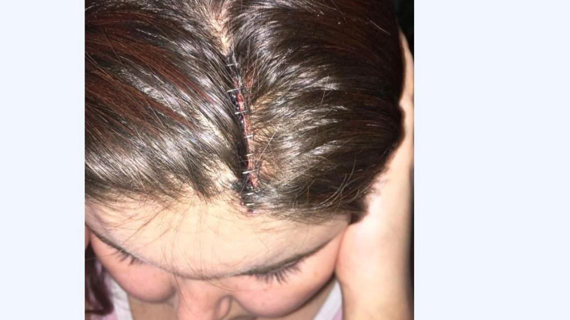 India Martin, 22, of Fort Valley, says Fort Valley police Lt. Antoine Jordan pushed her and caused her to fall and hit her head at the Medical Center of Peach County, Navicent Health. The GBI is investigating, and Jordan is on administrative leave.