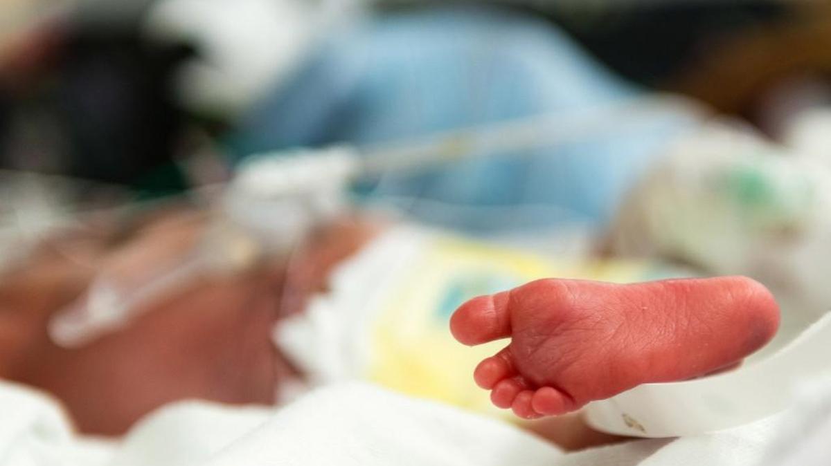 The tiny pink foot of a premature baby at the neonatal intensive-care unit at Lucile Packard Children’s Hospital in Palo Alto, California.